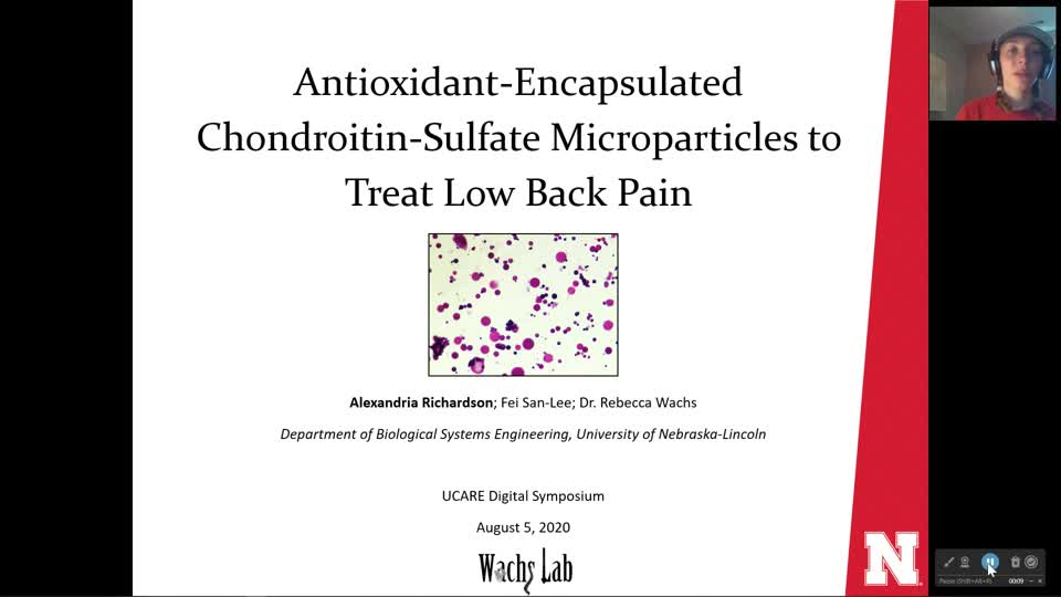 Antioxidant-Encapsulated Chondroitin-Sulfate Microparticles to Treat Low Back Pain