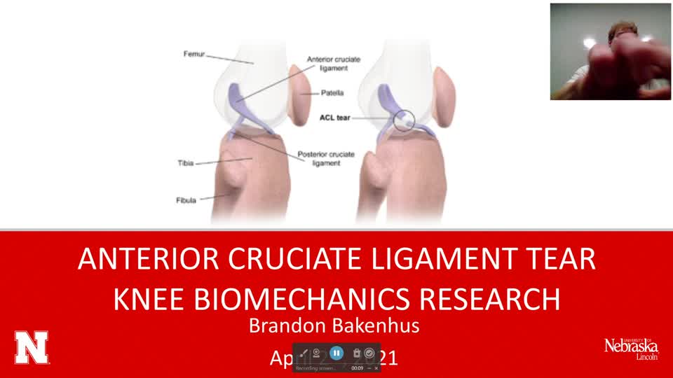 ACL Tear Knee Biomechanics Research
