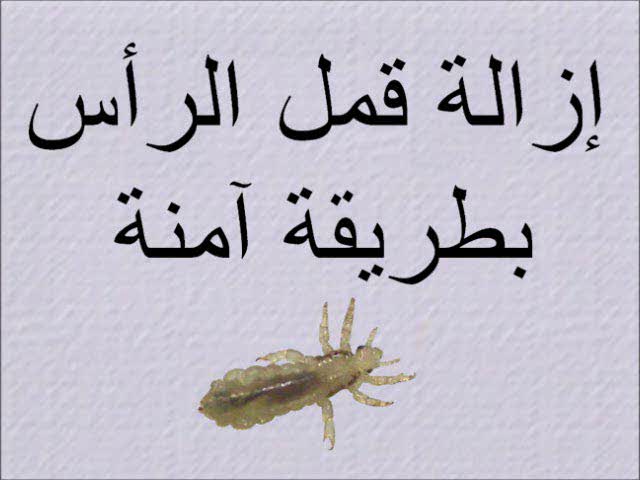 Removing Head Lice Safely (Arabic) إزالة قمل الرأس بطريقة آمنة